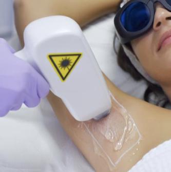 Laser Hair Removal